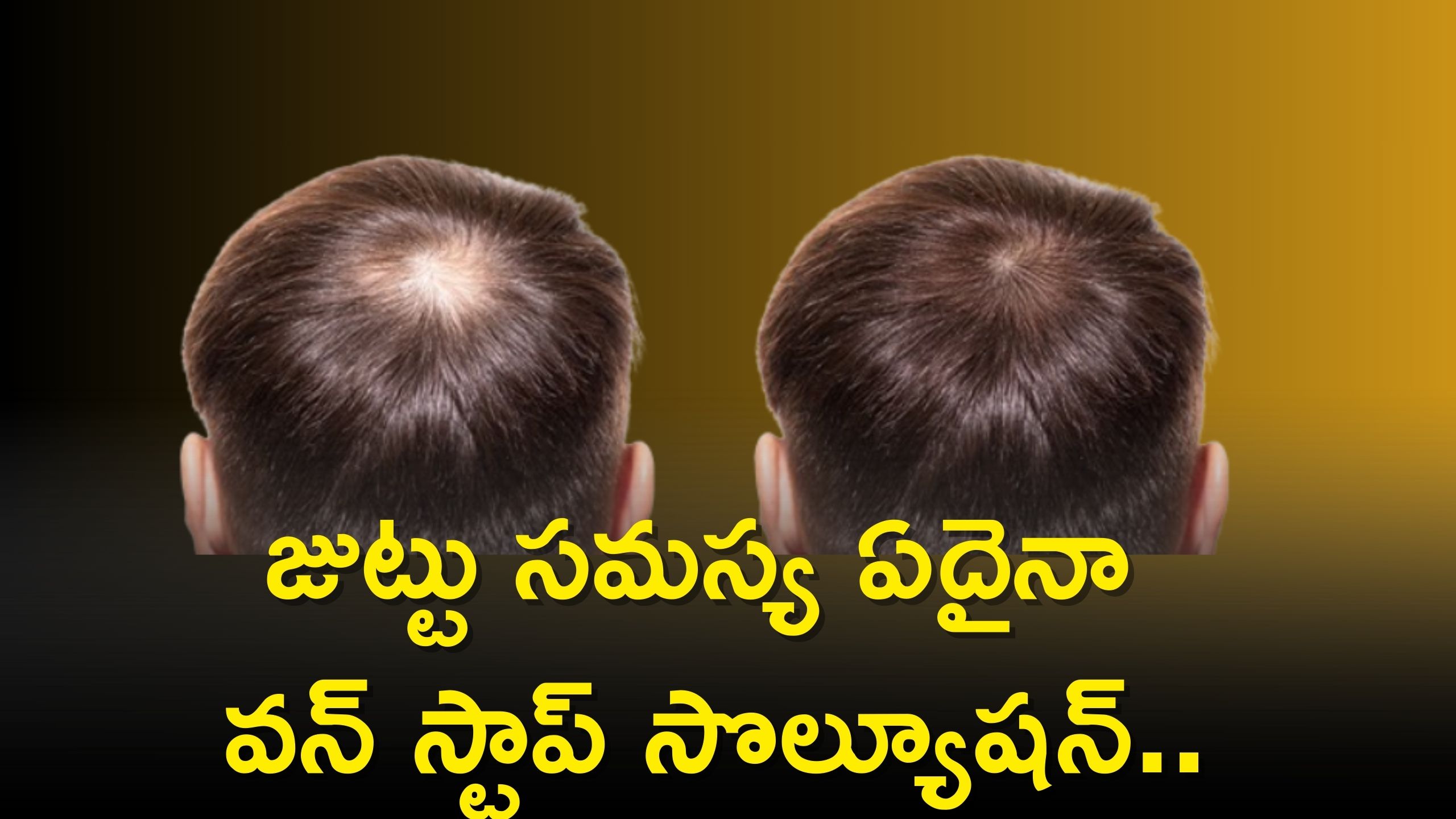 Hair Growth Tips: జుట్టు సమస్య ఏదైనా వన్ స్టాప్ సొల్యూషన్..ఈ చిట్కాలతో ఒత్తయిన మందమైన జుట్టు మీ సొంతం..