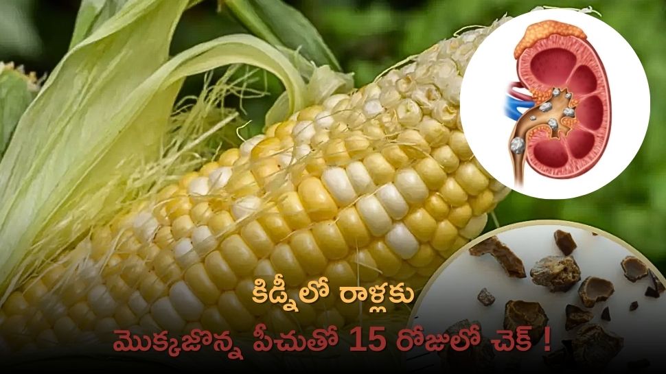 Benefits Of Corn Silk Helps To Control Kidney Stones And Effectively