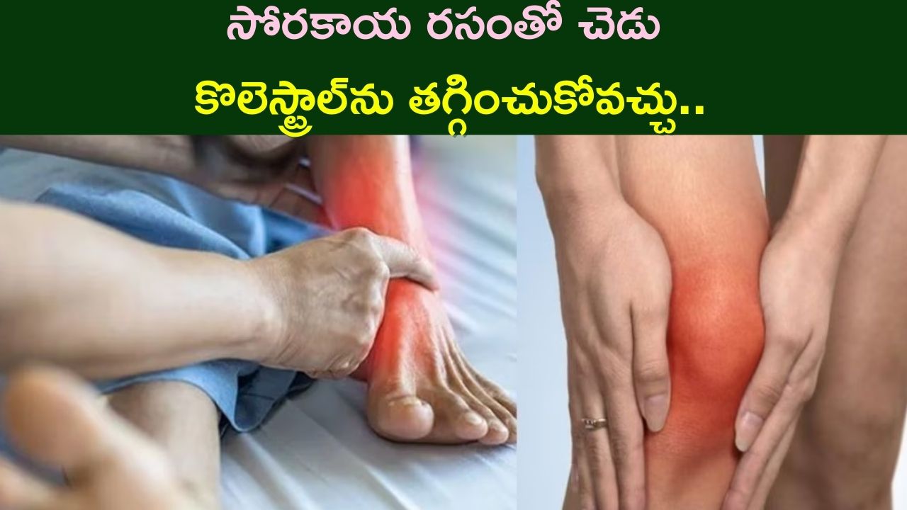 Uric Acid: యూరిక్ యాసిడ్ వల్ల వచ్చే వ్యాధులు..ఈ సమస్య నుంచి ఉపశమనం పొందడానికి చిట్కాలు!