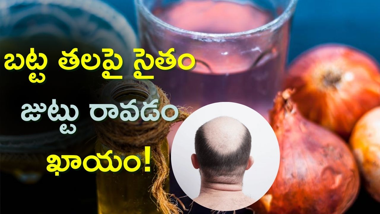 Red Onion For Hair: ఈ మిశ్రమంతో జుట్టు రాలడం తగ్గడమే కాదు..బట్ట తలపై సైతం జుట్టు రావడం ఖాయం!