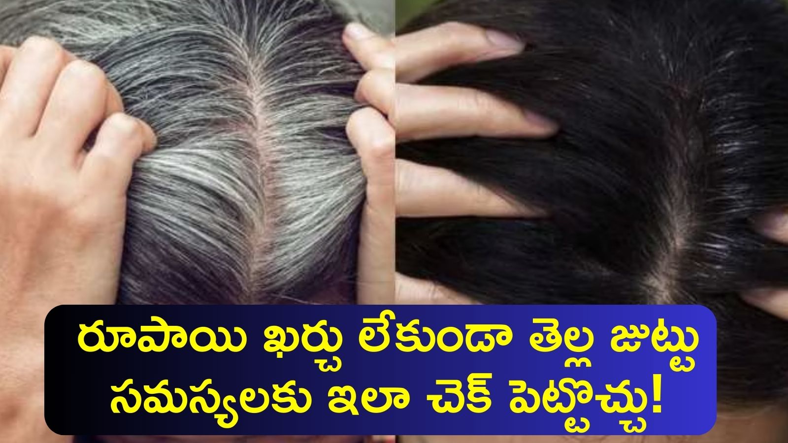 White Hair: రూపాయి ఖర్చు లేకుండా తెల్ల జుట్టు సమస్యలకు ఇలా చెక్‌ పెట్టొచ్చు!