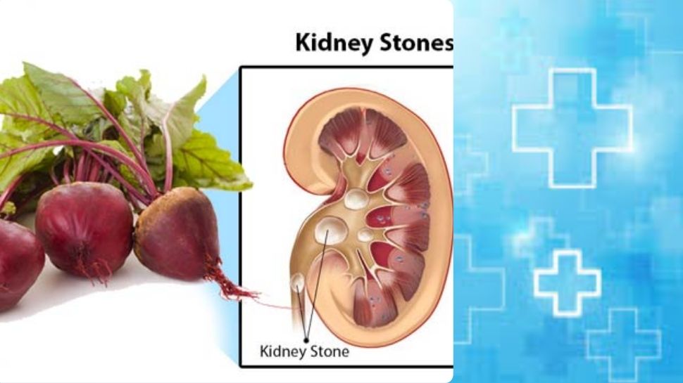 can-kidney-patients-eat-beetroot-what-are-the-disadvantages-of-this