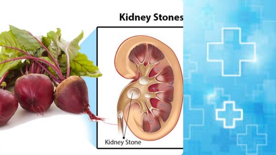 Can Kidney Patients Eat Beetroot What Are The Disadvantages Of This 