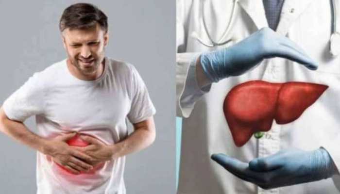 Home remedies for Fatty Liver: మీ ఇంటి కిచెన్లోనే ఫ్యాటీ లివర్‌కు మందు.. జన్మలో రమ్మన్నారాదు..