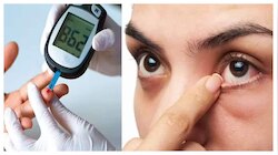 Beyond Blood Sugar: డయాబెటిస్‌తో బాధపడేవారికి ఈ 5 జబ్బులు కూడా ప్రాణాంతకం..
