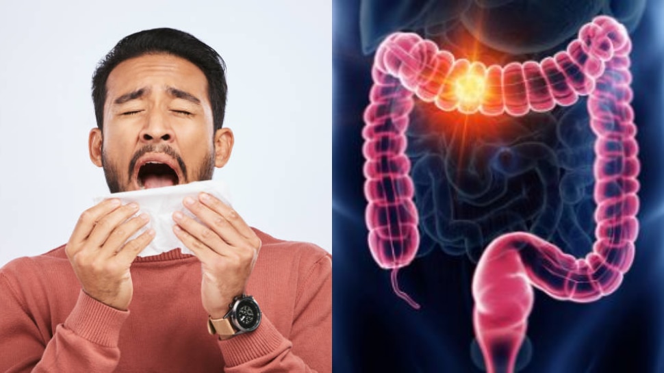Us man forceful sneeze: బాప్ రే.. గట్టిగా తుమ్మగానే.. పొట్ట చీల్చుకుని బైటపడ్డ పేగులు.. ఎక్కడో తెలుసా..?..