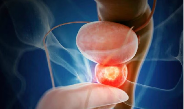 Prostate Cancer Signs: బాడీలోని ఈ 3 భాగాల్లో సమస్య ఉంటే ప్రోస్టేట్ కేన్సర్ కావచ్చు Prostate Cancer Signs: బాడీలోని ఈ 3 భాగాల్లో సమస్య ఉంటే ప్రోస్టేట్ కేన్సర్ కావచ్చు