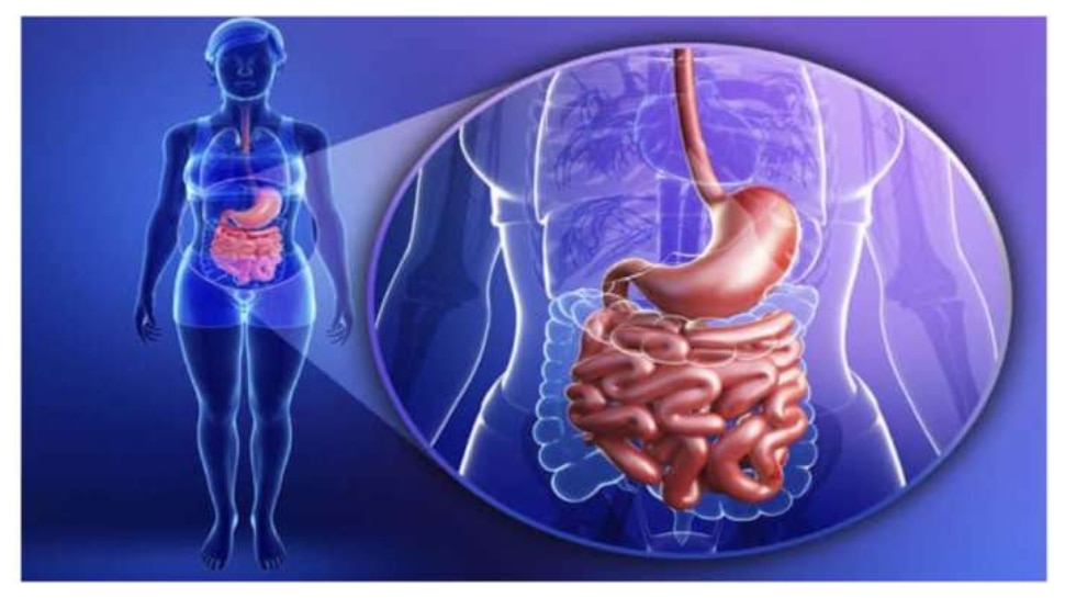 Gut Health: కడుపు ఆరోగ్యాన్ని పాడు చేసే 8 ఆహారాలు.. కచ్చితంగా వీటికి దూరంగా ఉండాల్సిందే..