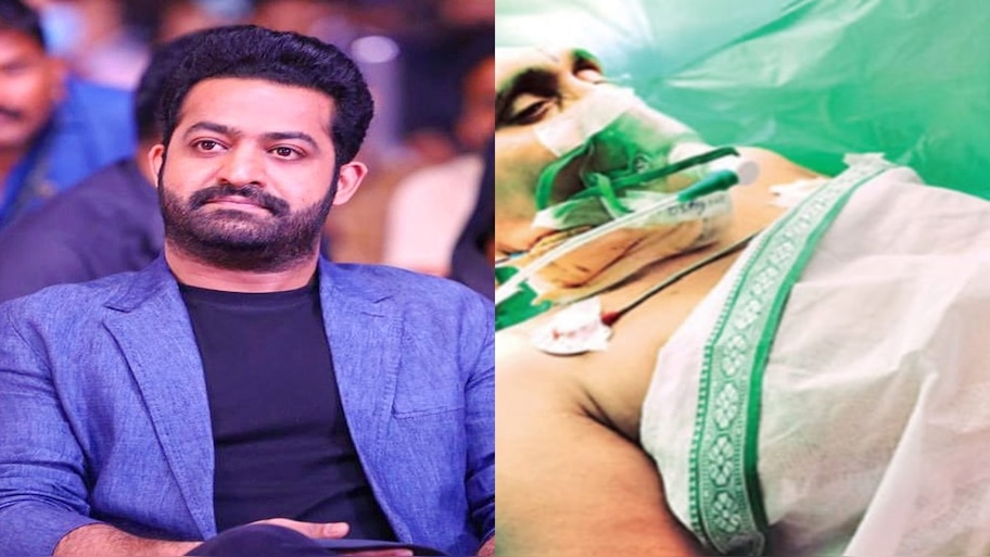 Jr NTR: ఎన్టీఆర్ మూవీ చూపిస్తూ అభిమానికి బ్రెయిన్ సర్జరీ.. దీనికి సహాయపడిన అవేక్ క్రానియోటమీ అంటే ఏంటి? 