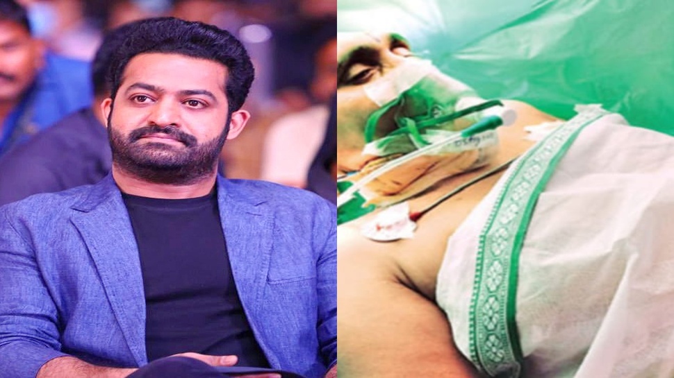 Jr NTR: ఎన్టీఆర్ మూవీ చూపిస్తూ అభిమానికి బ్రెయిన్ సర్జరీ.. దీనికి సహాయపడిన అవేక్ క్రానియోటమీ అంటే ఏంటి? Jr NTR: ఎన్టీఆర్ మూవీ చూపిస్తూ అభిమానికి బ్రెయిన్ సర్జరీ.. దీనికి సహాయపడిన అవేక్ క్రానియోటమీ అంటే ఏంటి?