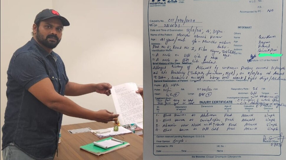 Manchu Manoj: మంచు మనోజ్‌ మెడికల్‌ రిపోర్టులో విస్తుగొలిపే విషయాలు.. తండ్రిపై పోలీసులకు ఫిర్యాదు