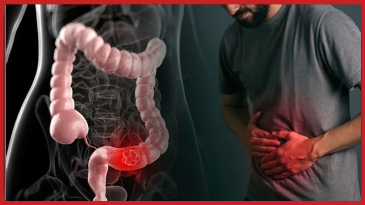 Constipation: మలబద్ధకాన్ని జాడించి తన్నే అద్భుతమైన ఆహారం పదార్థాలు.. Constipation: మలబద్ధకాన్ని జాడించి తన్నే అద్భుతమైన ఆహారం పదార్థాలు..