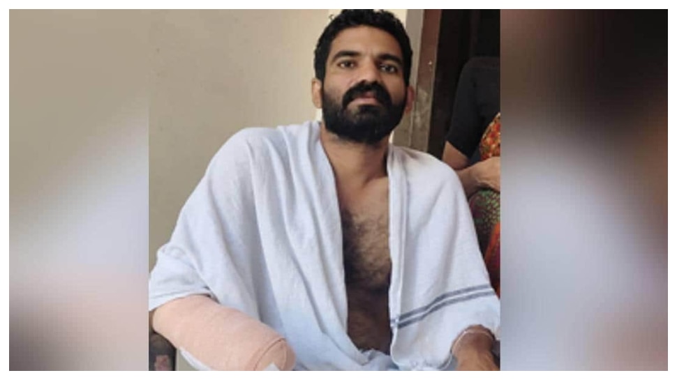 Fish Bite: అమ్మో.. చేప కొరికితే  చెయ్యి తీసేయాల్సి వచ్చింది.. అరుదైన ఇన్ఫెక్షన్ తస్మాత్‌ జాగ్రత్త..