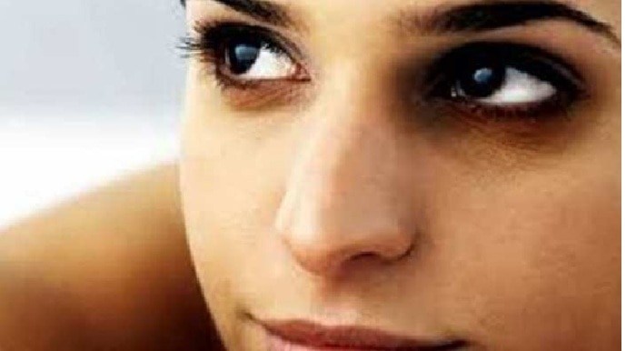 Dark Circles: ఈ విటమిన్లు లోపిస్తే కంటి కింద డార్క్ సర్కిల్స్ ఏర్పడుతాయని తెలుసా