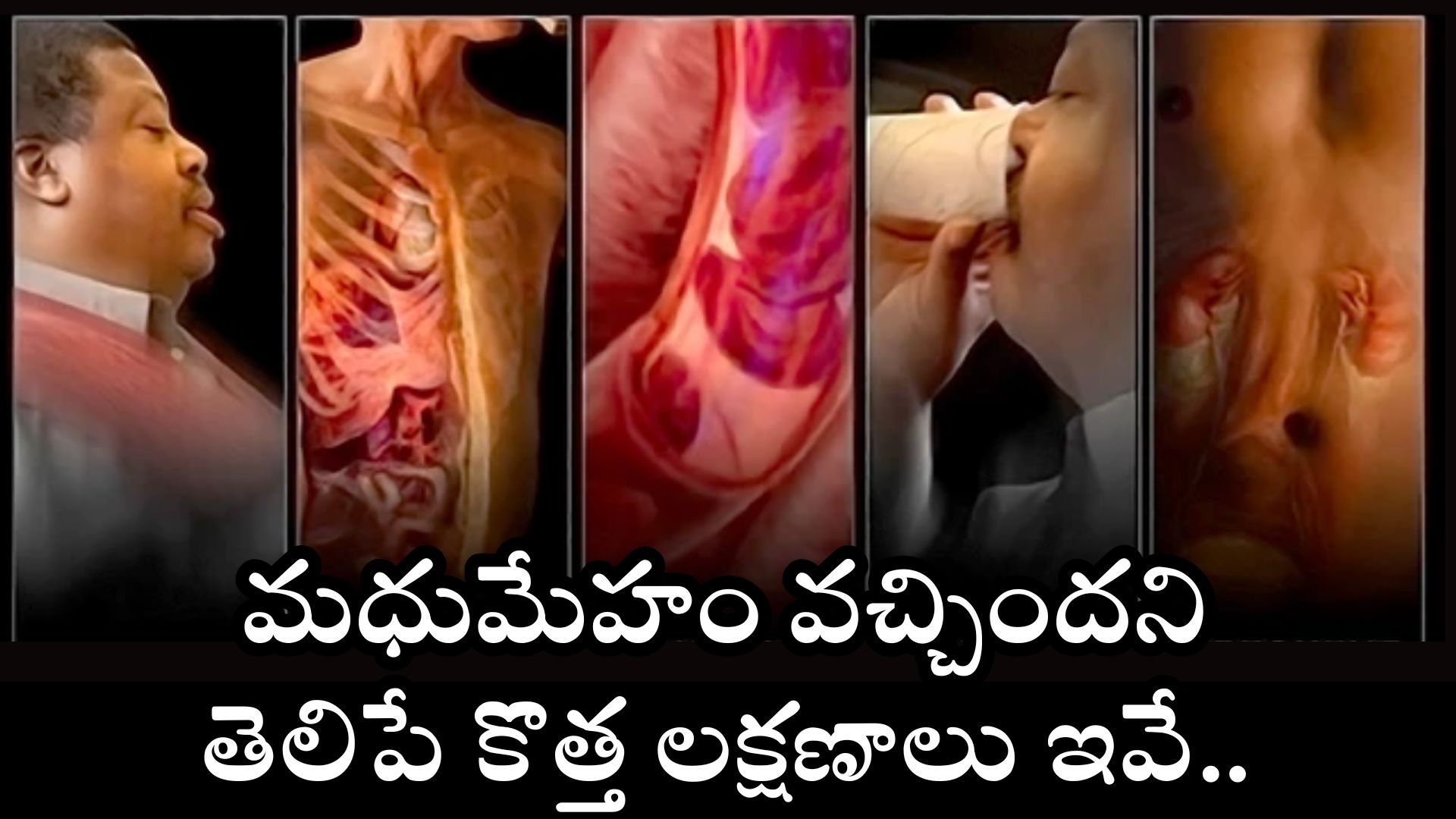 Diabetes Symptoms: మధుమేహం వచ్చిందని తెలిపే కొత్త లక్షణాలు ఇవే.. 