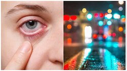 Diabetes: మీ కంట్లో ఈ సమస్య ఉందా? ముందే చెప్తున్నా వింటే పెద్ద ప్రమాదం నుంచి బయటపడతారు!