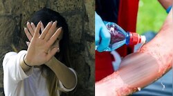Delhi Student Acid Attack: ఢిల్లీలో యువతిపై యాసిడ్ దాడి ఘటన.. వెలుగులోకి షాకింగ్ నిజాలు.. అసలేం జరిగిందంటే..?