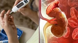 Chronic Kidney Disease: కిడ్నీ వ్యాధి ఉన్నవారిలో షుగర్ ఎందుకు పడిపోతుంది?