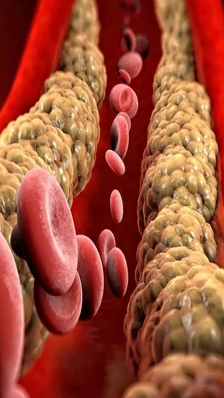  High Cholesterol: కొలెస్ట్రాల్ తగ్గాలంటే... ఈ 7 అలవాట్లు తప్పనిసరి..!