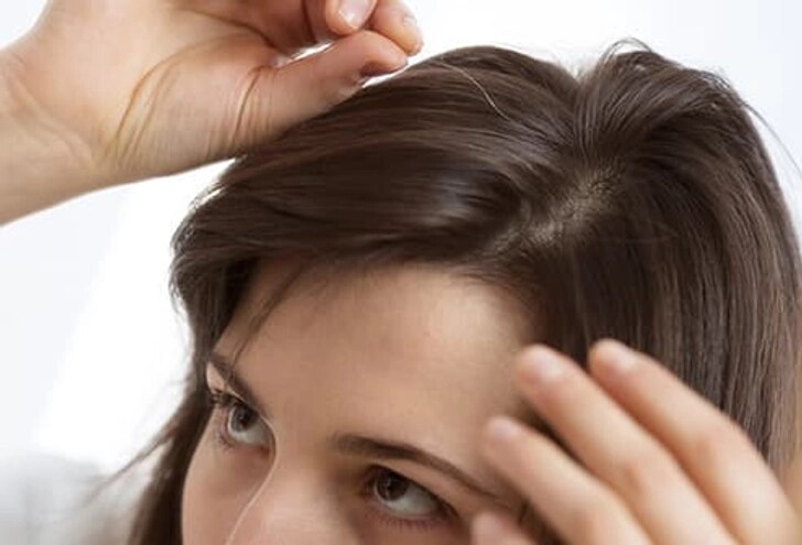 Foods That Cause White Hair 