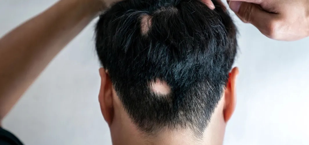 Hair Care Tips