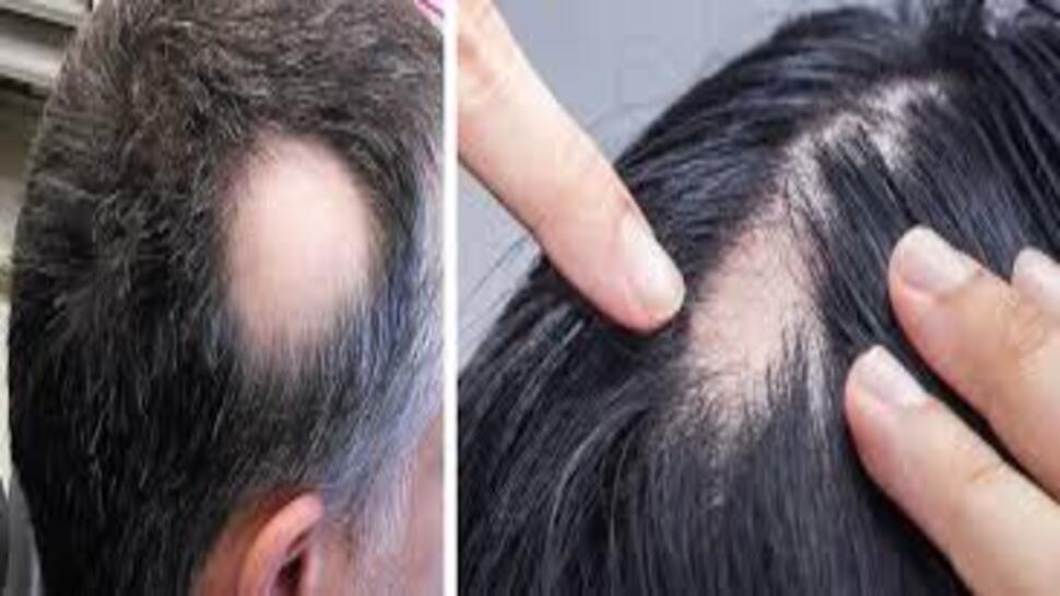Hair Growth Food