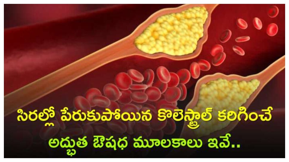 Bad Cholesterol: చెడు కొలెస్ట్రాల్‌ని సైడ్ ఎఫెక్ట్స్ లేకుండా తక్షణమే తగ్గించే సహజ మూలిక..!