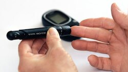  Blood sugar:  లంచ్ చేసే ముందు ఈ డ్రైఫ్రూట్ తింటే చాలు.. మీ షుగర్ ఫాస్టింగులో సైతం నార్మల్ అవడం ఖాయం 