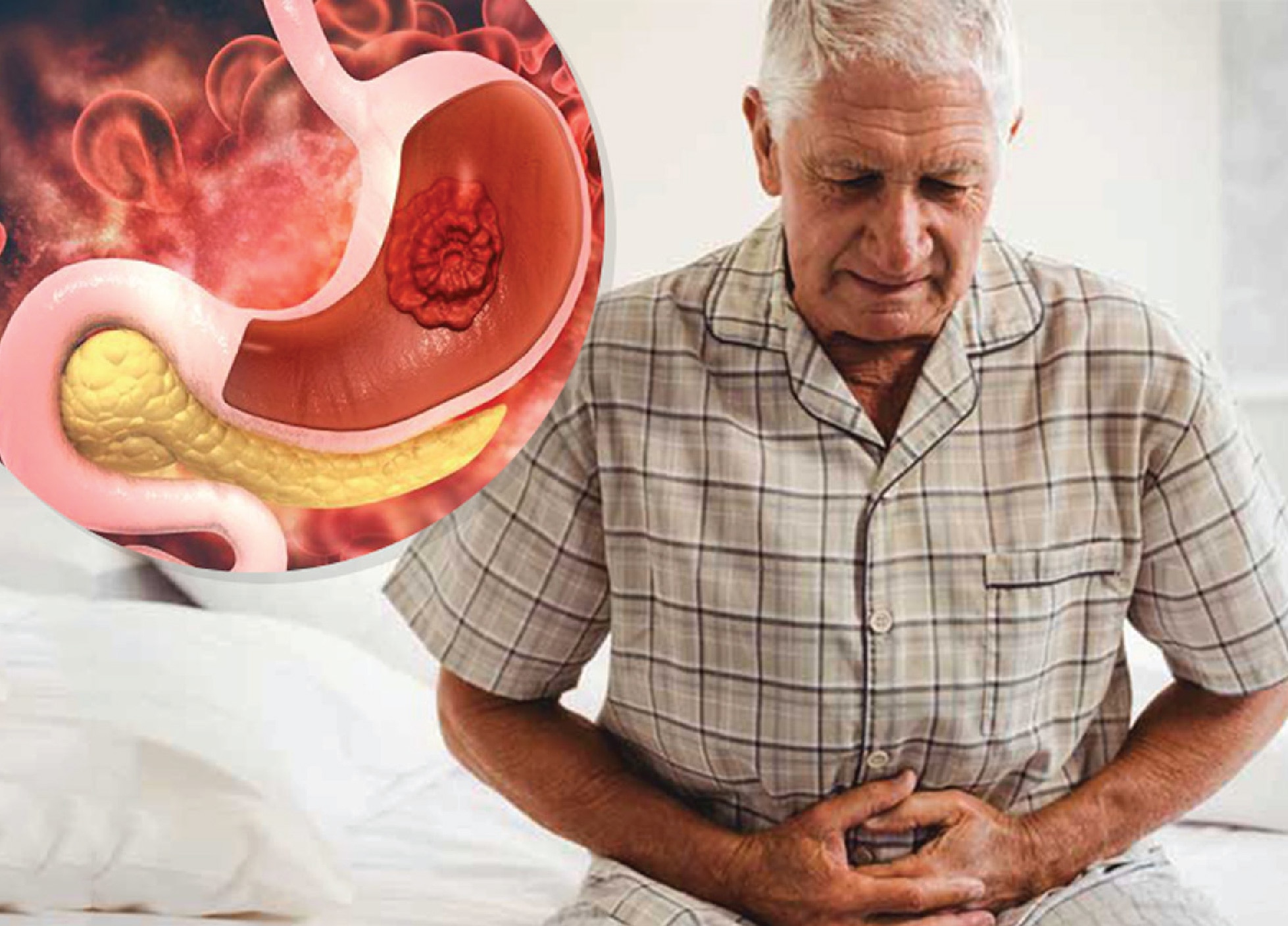 Early Signs Of Stomach Cancer