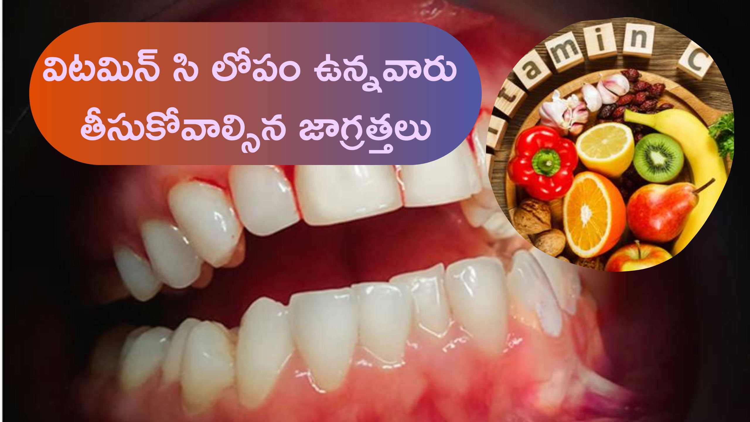 Precautions To Taken And Foods ToEaten By Those With Vitamin C Deficiency Vitamin C Deficiency