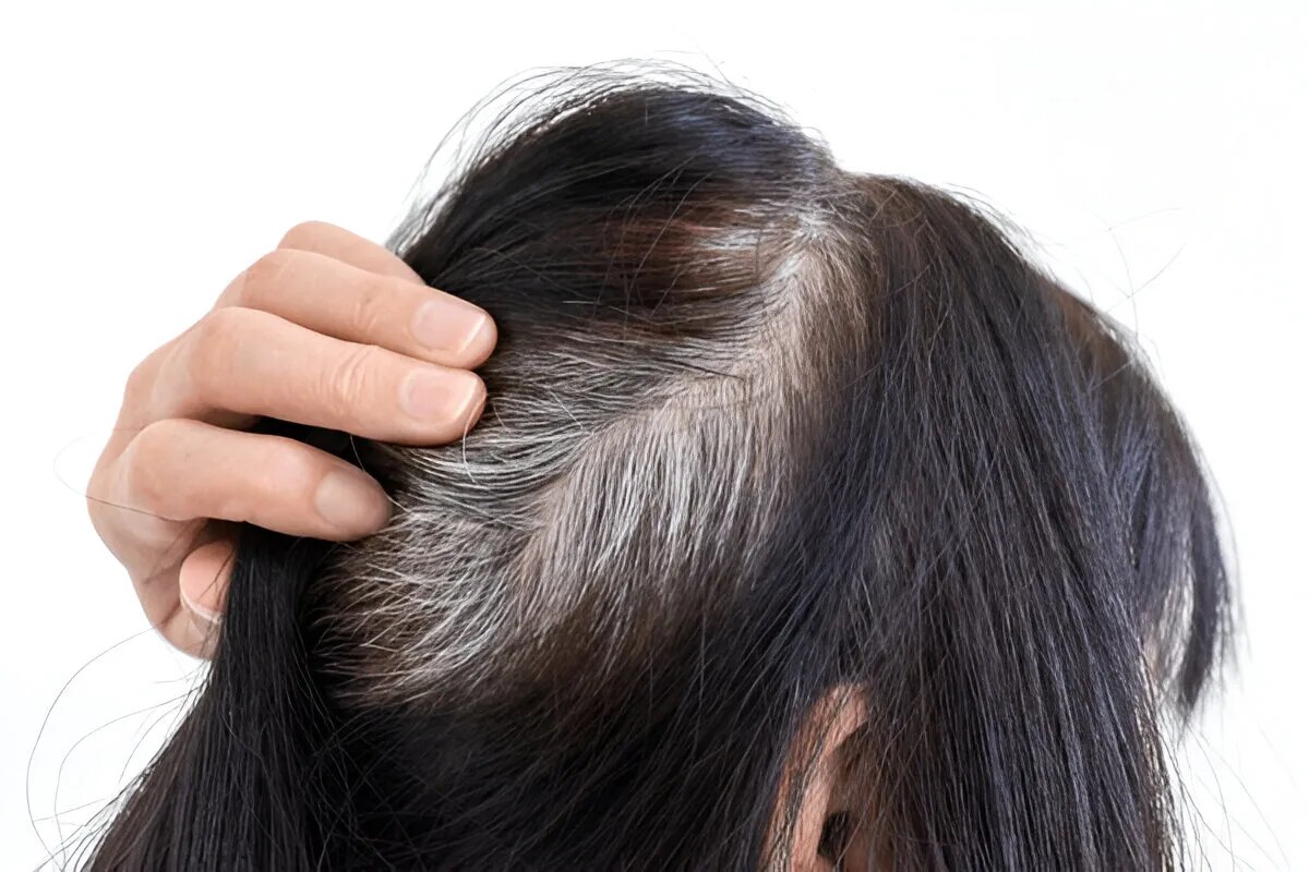 White Hair Prevention Pack