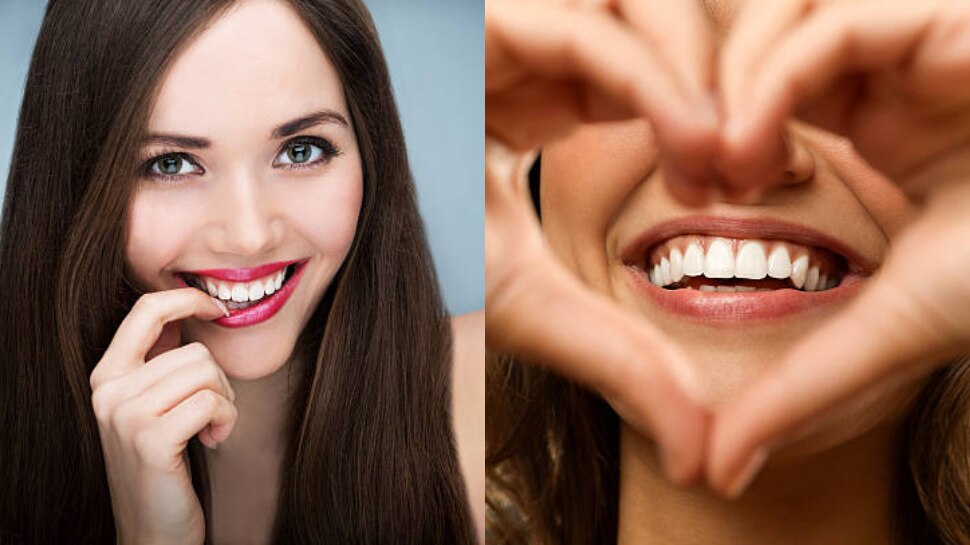 Amazing teeth Whitening tips to brighten your smile in short time ...