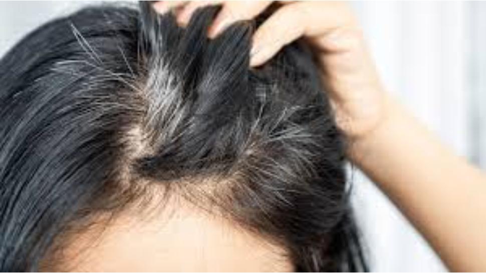 white hair remedies: