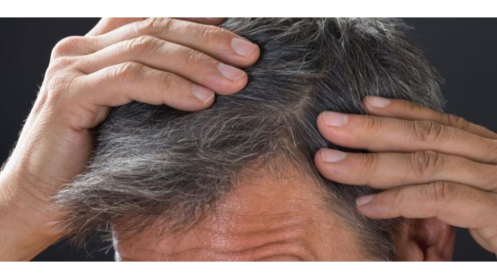 White hair tips: