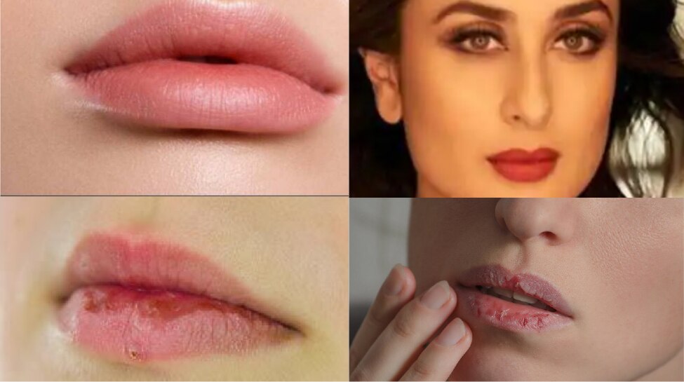 Simple beauty tips for lip care in winter/Lip care tips శీతాకాలంలో