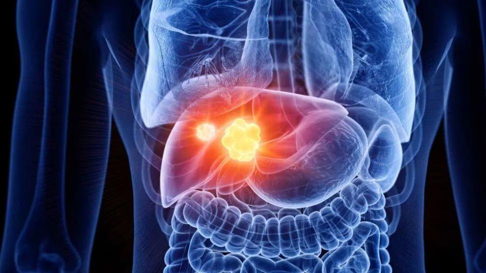Liver Damage Symptoms