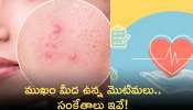 Acne Tells Health: మీ ముఖం మీద ఉన్న మొటిమ మీ ఆరోగ్యం గురించి ఏమి చెబుతాయో తెలిస్తే షాక్‌ అవుతారు