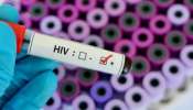 HIV Infections: హెచ్ఐవీ విధ్వంసం.. 828 కి  పాజిటివ్, 47 మంది మృతి.. ఎక్కడో తెలుసా..?