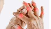 Arthritis Precautions: ఆర్ధరైటిస్ తో బాధపడుతున్నారా, వెంటనే ఈ 5 పుడ్స్ మానేయండి