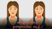 Hypothyroidism: ఆడవారిలో ఈ లక్షణాలు కనిపిస్తే హైపోథైరాయిడిజం  ఉన్నట్టే..!