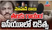 Mohan Babu:మోహన్ బాబు తలకు గాయం.. ఐసీయూలో చికిత్స..