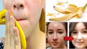 Banana Peel Benefits: అరటి తొక్కతో అదిరిపోయే  సౌందర్యాన్ని పెంచే  ప్రయోజనాలు ఇవే..