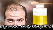 Hair Fall: ఈ ఒక్క రసం జుట్టుకు అప్లై చేస్తే.. జుట్టు రాలడం, చుండ్రు సమస్యలకు చెక్‌!