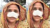 Husband Bites Wife Nose: ఇదెక్కడి విడ్డూరం.. భార్య ముక్కును కొరికేసిన భర్త.. కారణం తెలిస్తే షాక్ అవ్వడం పక్కా..