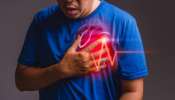 Heart Attack Symptoms: హెల్త్ అలర్ట్.. హార్ట్ ఎటాక్ అలారం సిగ్నల్స్ ఇవే.. గుర్తు పెట్టుకోండి..!
