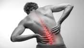 Back Pain: బ్యాక్ పెయిన్ బాధిస్తోందా.. ప్రధాన కారణాలు ఏంటో తెలుసా..? 
