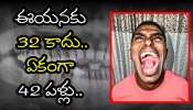42 Teeth Record: వావ్.. ఈయనకు 32 కాదు.. ఏకంగా 42 పళ్లు.. 