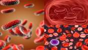 Anemia Test: టెస్టులు అవసరం లేదు.. రక్తహీనతను ఇలా కూడా కనుక్కోవచ్చు 