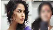 Anupama Parameswaran: ముఖం నిండా గాయాలతో అనుపమ.. టెన్షన్ లో ఫ్యాన్స్..!