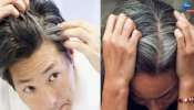  White Hair Home Remedies: వంటింట్లో దొరికే ఈ వస్తువులను Hennaలో కలిపి తలకు పెడితే తెల్లవెంట్రుక రమ్మన్నారాదు 